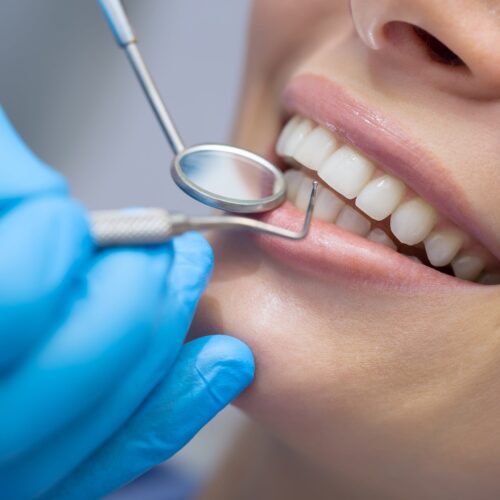 Ortodonta Praga Południe jak wyselekcjonować idealnego stomatologa?